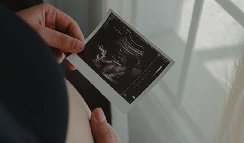 Birth Control and Abortion in Islam