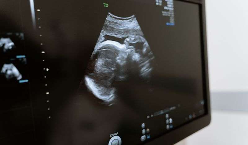 Birth Control and Abortion in Islam